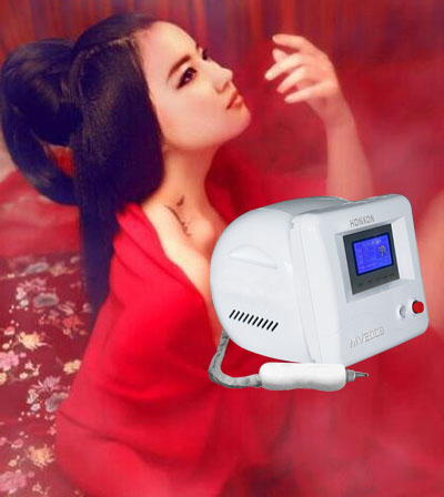 激光洗纹身仪器