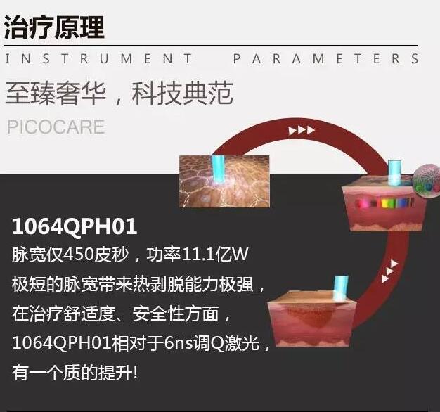 宏强皮秒激光美容仪器设备