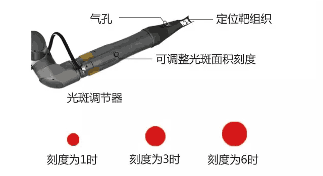 1064VYH去斑美容仪器设备